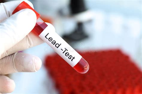 Understanding Your Lead Blood Test Results: What Do They Mean?