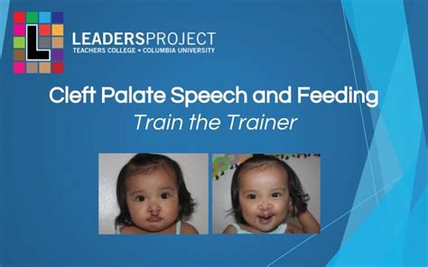 leaders project cleft palate