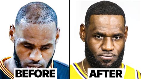 lebron james before and after hair