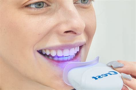 List Of Led Light Teeth Whitening 2023