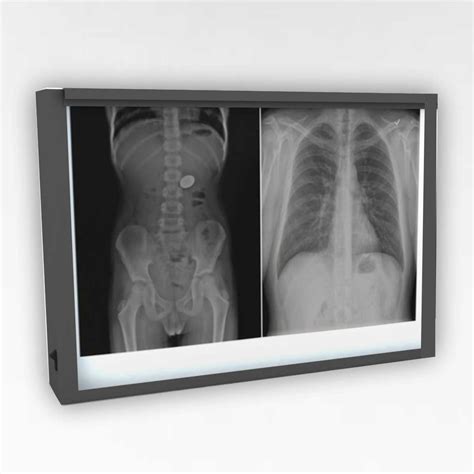 Led X Ray Light Box
