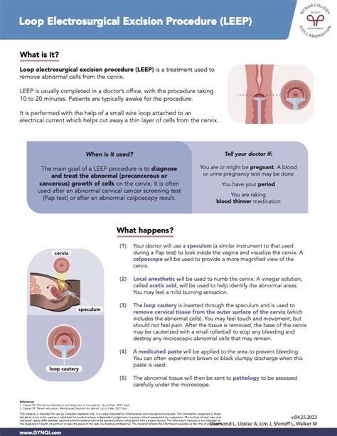 LEEP Procedure Recovery: A Smooth and Speedy Healing Guide