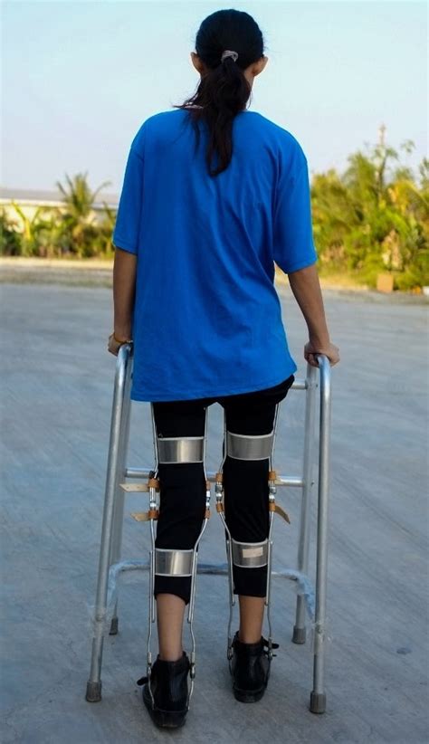 Leg Braces Appointment