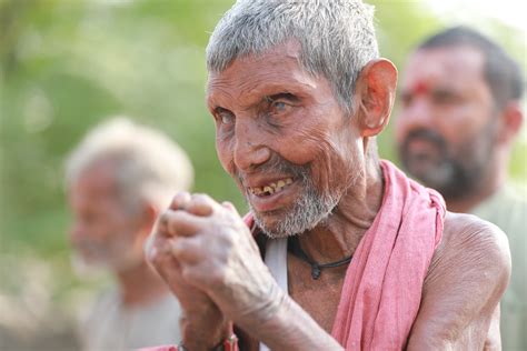 leprosy cured person