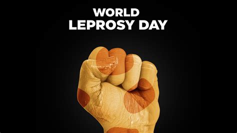 leprosy day in india