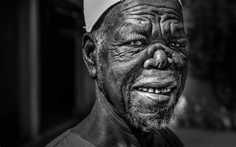 leprosy face images