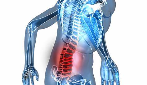Si te duele la espalda podrías tener esta enfermedad