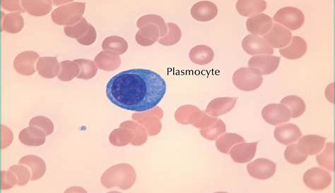 Leucemie A Plasmocytes Pronostic Dysglobulinémies