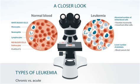 leukemia rare types