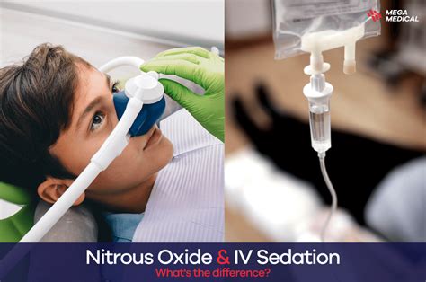 Levels Of Nitrous Oxide Sedation
