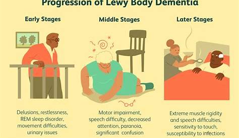 Stages and Progression of Lewy Body Dementia