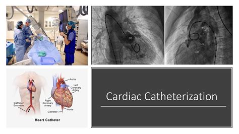 lhc cardiology procedure