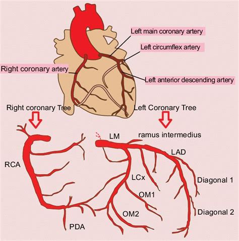 lhc definition cardiac