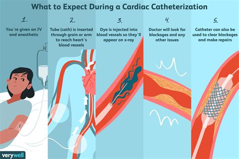 lhc test cardiac