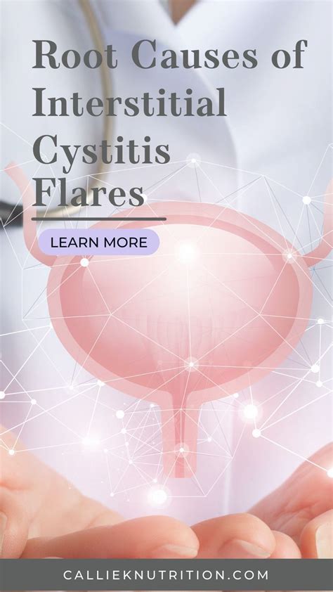 Licorice Root And Interstitial Cystitis