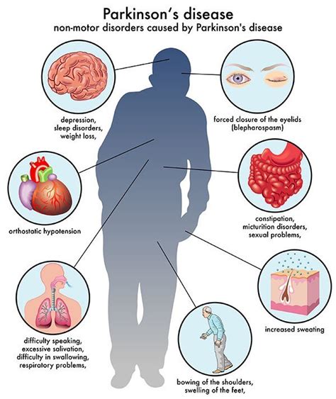 life expectancy with parkinson's disease nhs