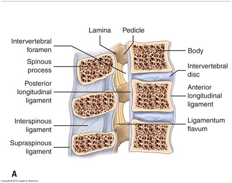 ligament ossification of cervical spine