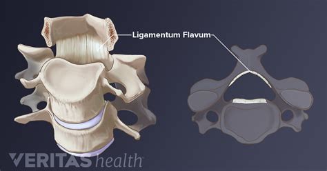 ligamentum flavum redundancy definition