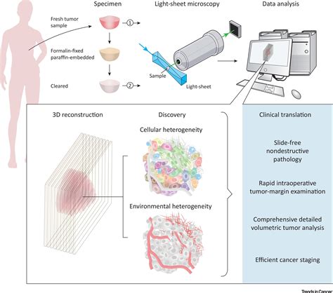 Light Sheet Microscopy Cancer