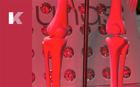 Light Therapy Bone Healing