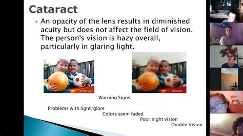 Lighthouse Blindness