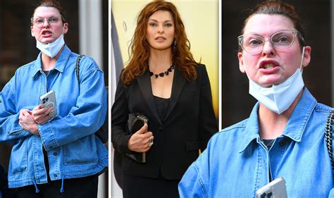 linda evangelista botched surgery