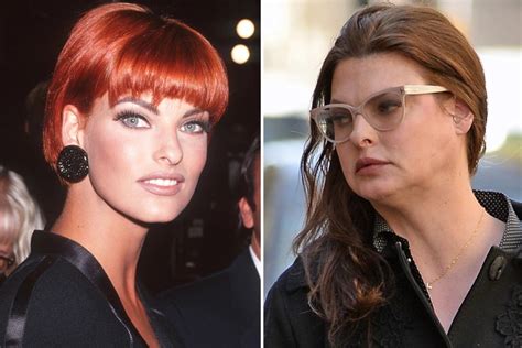 linda evangelista coolsculpting damage photos