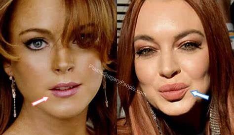 Unveiling The Enigmatic Allure Of Lindsay Lohan's Lips
