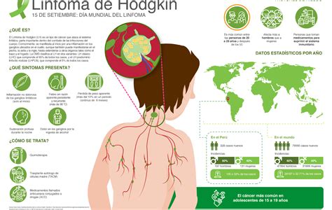 linfoma de hodgkin supervivencia