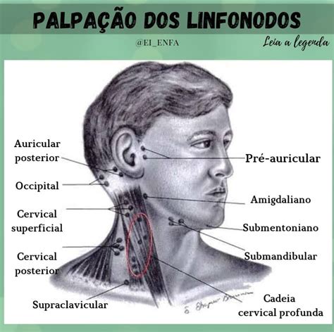 linfonodo em região inguinal