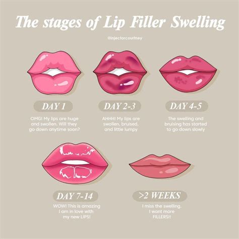 Lip Filler Process