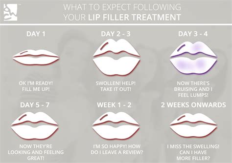 Lip Filler Side Effects Reddit