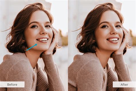 Lip Filler Visualizer