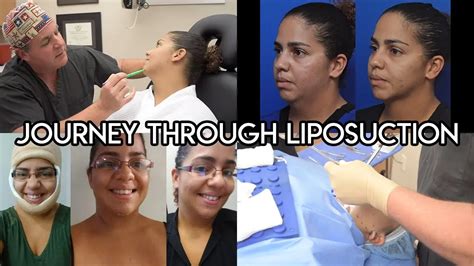 Liposuction Jacksonville Fl