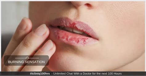 Lips Burning And Red