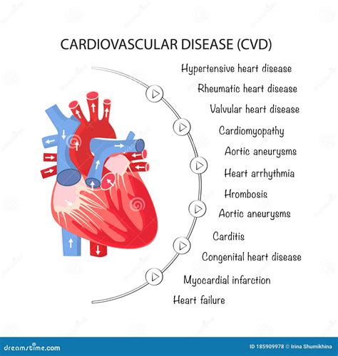 lista de enfermedades cardiovasculares