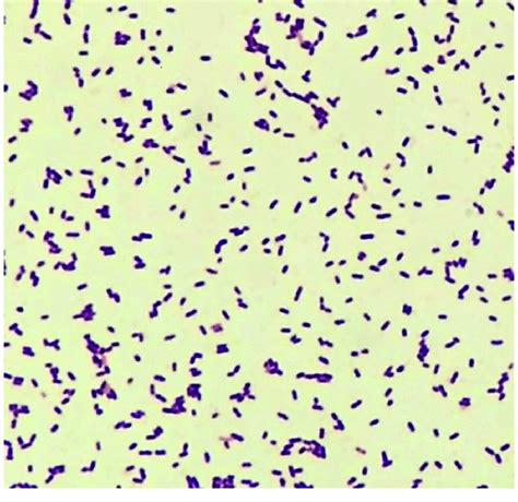 listeria gram stain cdc