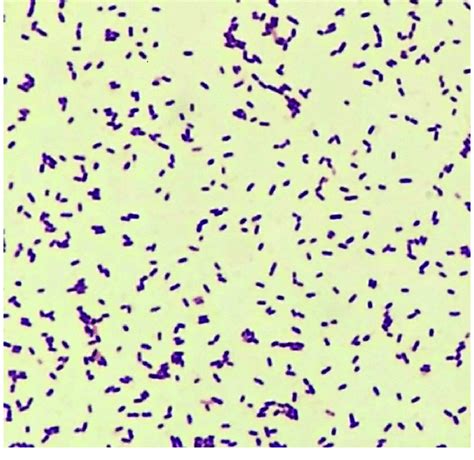 listeria monocytogenes bacteria gram stain