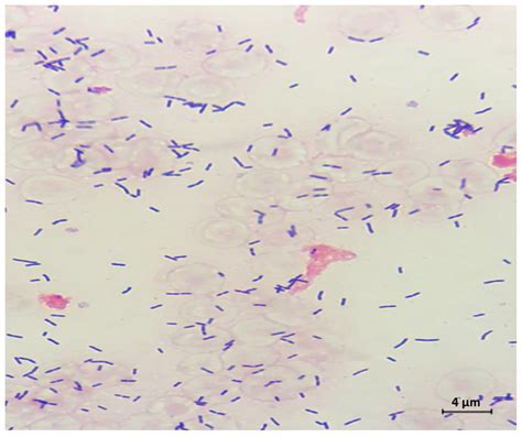 listeria monocytogenes gram stain