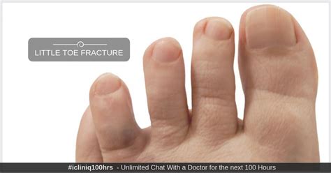 little toe probable function