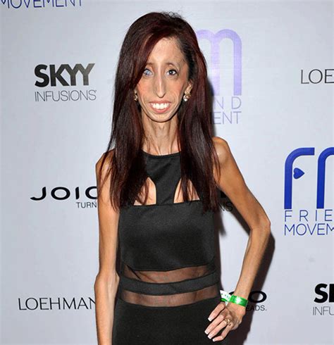 lizzie velasquez net worth