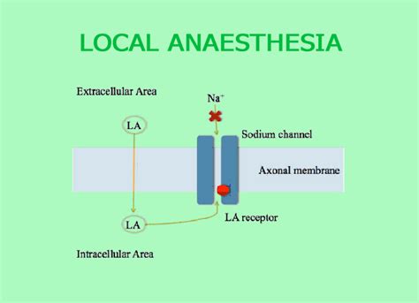 Local Anaesthesia Without Injection