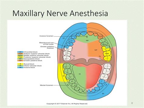 Local Anesthesia Nerve Stimulation