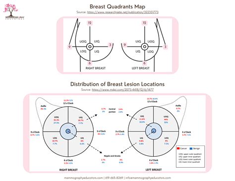location breast leaks