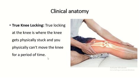 Locking Knee Syndrome