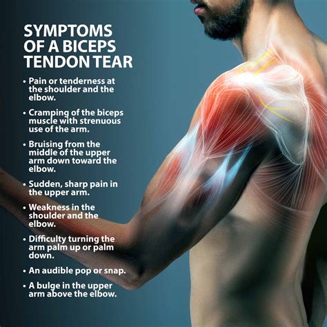 long tendon in upper arm repair