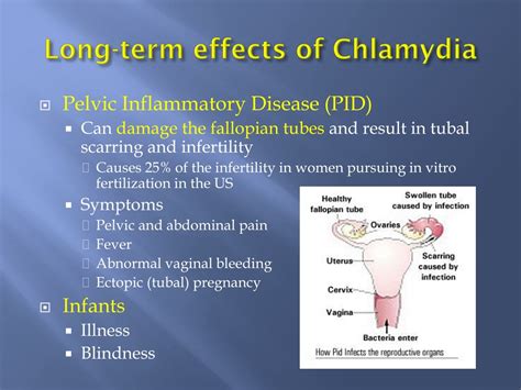 Chlamydia Signs, Symptoms, and Complications