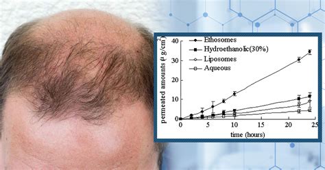 long term effects of finasteride in men