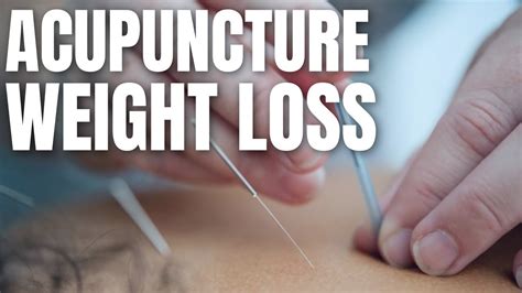Lose Weight Through Acupuncture