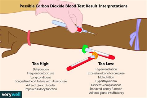 Understand Your Health: What Does a Low CO2 Blood Test Mean?